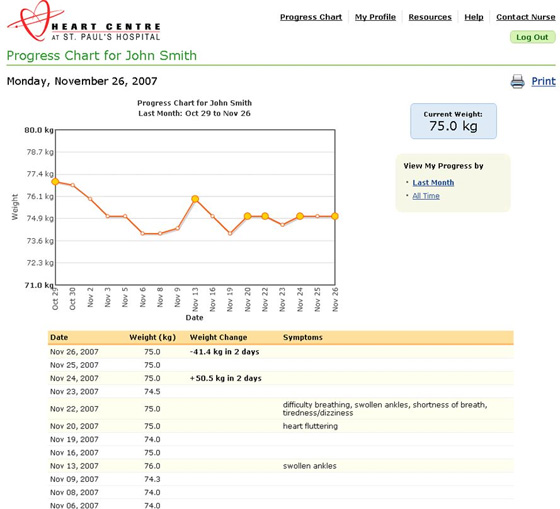 Weight progress chart for patient at St. Paul's Hospital 